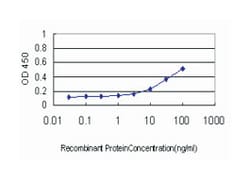 nuclear factor of kappa light polypeptide gene enhancer in B-cells inhibitor,