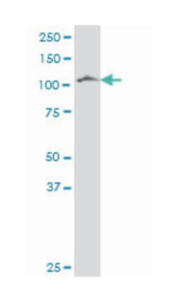 protocadherin 7, Mouse, Polyclonal Antibody, Abnova 50 &mu;L | Buy Online | Abnova Corporation | Fisher Scientific