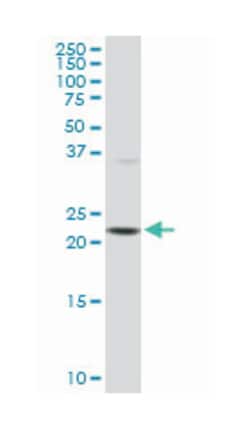 protein-L-isoaspartate (D-aspartate) O-methyltransferase, Mouse, Clone: