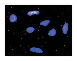 platelet-derived growth factor receptor, alpha polypeptide, Mouse, Clone: 2D2-1A11, Abnova&trade;