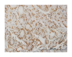 protein phosphatase 3 (formerly 2B), catalytic subunit, alpha isoform,