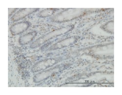 protein kinase, cGMP-dependent, type I, Mouse, Clone: 2B3, Abnova 100&mu;g;