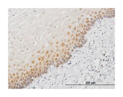 heat shock 70kDa protein 1B, Mouse, Clone: 2D11, Abnova 100&mu;g; Unlabeled:Antibodies,