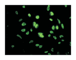 inhibitor of DNA binding 1, dominant negative helix-loop-helix protein,