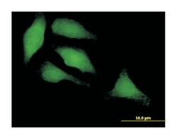 interferon regulatory factor 3, Mouse, Polyclonal Antibody, Abnova 50&mu;L;