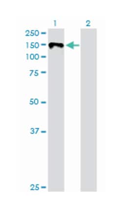 v-kit Hardy-Zuckerman 4 feline sarcoma viral oncogene homolog, Rabbit, Purified MaxPab Polyclonal Antibody, Abnova 100 &mu;g | Buy Online | Abnova | Fisher Scientific