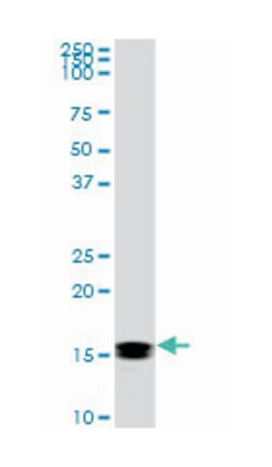 nonmetastatic cells 2, protein (NM23B) expressed in, Mouse, Clone: 1D3, Abnova 100 &mu;g | Buy Online | Abnova Corporation | Fisher Scientific
