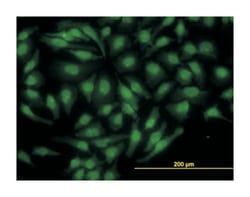 nuclear receptor subfamily 4, group A, member 2, Mouse, Clone: 4A6, Abnova
