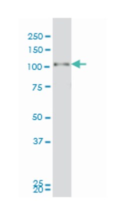 progesterone receptor, Mouse, Clone: 2C2, Abnova™
