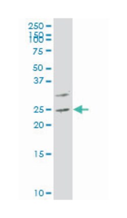 protein phosphatase 1, regulatory (inhibitor) subunit 2, Mouse, Polyclonal