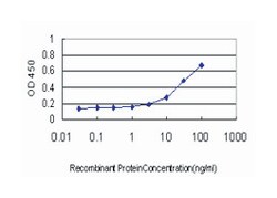 proteasome (prosome, macropain) subunit, beta type, 6, Mouse, Clone: S51,