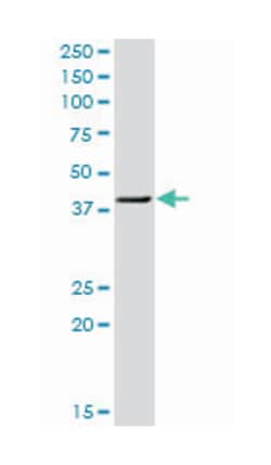 twinfilin, actin-binding protein, homolog 1 (Drosophila), Rabbit, Purified