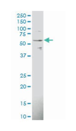 interleukin 1 receptor, type I, Mouse, Polyclonal Antibody, Abnova 50&mu;L;