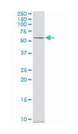 SMAD family member 4, Mouse, Clone: 3E2, Abnova 100&mu;g; Unlabeled:Antibodies,