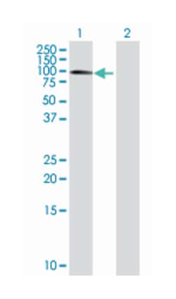 methyl-CpG binding domain protein 1, Mouse, Polyclonal Antibody, Abnova