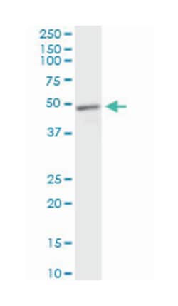 methyl CpG binding protein 2 (Rett syndrome), Mouse, Clone: 4B6, Abnova