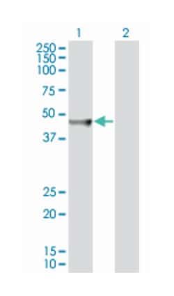 mevalonate (diphospho) decarboxylase (B01), Mouse anti-Human, Polyclonal