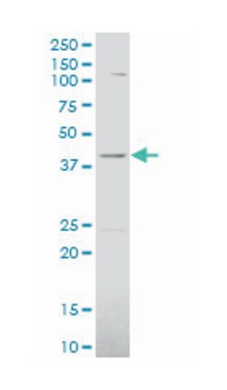 mevalonate kinase, Mouse, Polyclonal Antibody, Abnova 50&mu;L; Unlabeled:Antibodies,