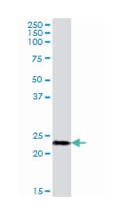 NADH dehydrogenase (ubiquinone) 1 beta subcomplex, 10, 22kDa, Mouse, Purified