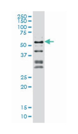 nuclear factor I/C (CCAAT-binding transcription factor), Mouse, Clone: 1D6, Abnova&trade;
