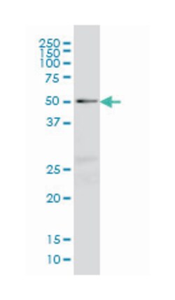 NFIC, Mouse, Clone: 2B6, Abnova 200&mu;L; Unlabeled:Antibodies, Monoclonal