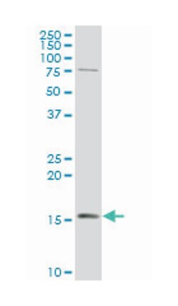prefoldin subunit 5, Mouse, Polyclonal Antibody, Abnova 50&mu;L; Unlabeled:Antibodies,