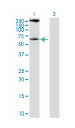 phosphatidylinositol-5-phosphate 4-kinase, type II, alpha, Rabbit, Purified