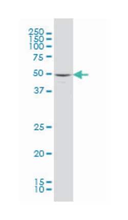 mitogen-activated protein kinase 10, Mouse, Clone: 3A3-1A8, Abnova 100 &mu;g | Buy Online | Abnova | Fisher Scientific