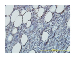 RAP2B, Mouse, Clone: 4F12-3C6, Abnova 100&mu;g; Unlabeled:Antibodies, Monoclonal