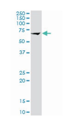 arginyl aminopeptidase (aminopeptidase B), Mouse, Polyclonal Antibody, Abnova 50 &mu;L | Buy Online | Abnova Corporation | Fisher Scientific