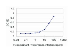 chemokine (C-X-C motif) ligand 12 (stromal cell-derived factor 1), Mouse,