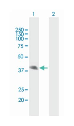 surfactant protein B, Mouse, Polyclonal Antibody, Abnova 50&mu;L; Unlabeled:Antibodies,