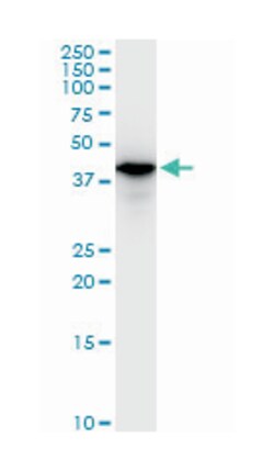 SWI/SNF related, matrix associated, actin dependent regulator of chromatin,