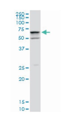 SWI/SNF related, matrix associated, actin dependent regulator of chromatin,