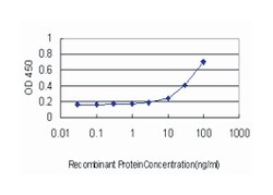 sphingomyelin phosphodiesterase 2, neutral membrane (neutral sphingomyelinase),