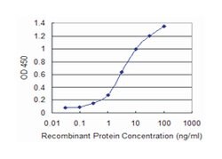 SNCA, Mouse, Clone: 2E4, Abnova 100 &mu;g | Buy Online | Abnova Corporation | Fisher Scientific