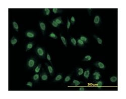 TAF11 RNA polymerase II, TATA box binding protein (TBP)-associated factor,