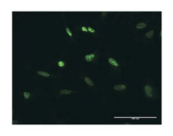 transcription elongation factor B (SIII), polypeptide 3 (110kDa, elongin