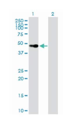 vitamin D (1,25- dihydroxyvitamin D3) receptor, Mouse, Purified MaxPab