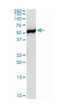 YES1 (M02), Mouse anti-Human, Clone: 3C6, Abnova™