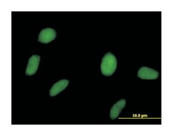 speckle-type POZ protein, Mouse, Purified MaxPab&trade; Polyclonal Antibody, Abnova&trade;
