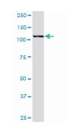 HIP1, Mouse, Purified MaxPab Polyclonal Antibody, Abnova 50&mu;g; Unlabeled:Antibodies,