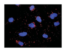 HLA-DQA1, Mouse, Clone: 1A3, Abnova 100 &mu;g | Buy Online | Abnova Corporation | Fisher Scientific