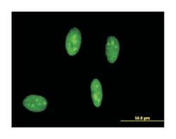 interferon production regulator, Mouse, Clone: 2C5, Abnova&trade;