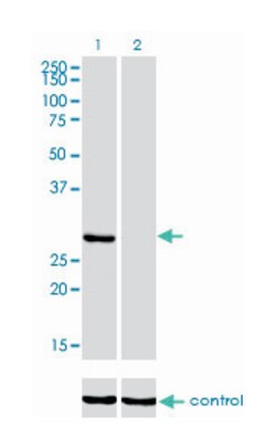 ketohexokinase (fructokinase), Mouse, Clone: 1H6-2B6, Abnova 100&mu;g;