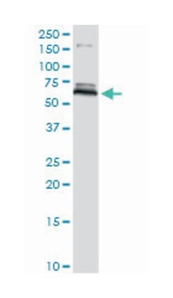 MAOB, Rabbit, Purified MaxPab Polyclonal Antibody, Abnova 100&mu;g; Unlabeled:Antikroppar