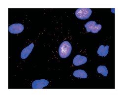 matrix metallopeptidase 7 (matrilysin, uterine), Rabbit, Purified MaxPab Polyclonal Antibody, Abnova 100 &mu;g | Buy Online | Abnova | Fisher Scientific