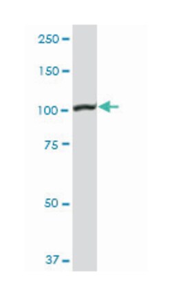 mutS homolog 2, colon cancer, nonpolyposis type 1 (E. coli), Rabbit, Purified