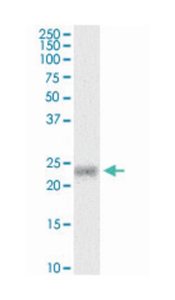 myosin, light chain 5, regulatory, Mouse, Clone: 3D12, Abnova 100 &mu;g | Buy Online | Abnova Corporation | Fisher Scientific