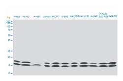 nonmetastatic cells 1, protein (NM23A) expressed in, Mouse, Clone: 1D7,